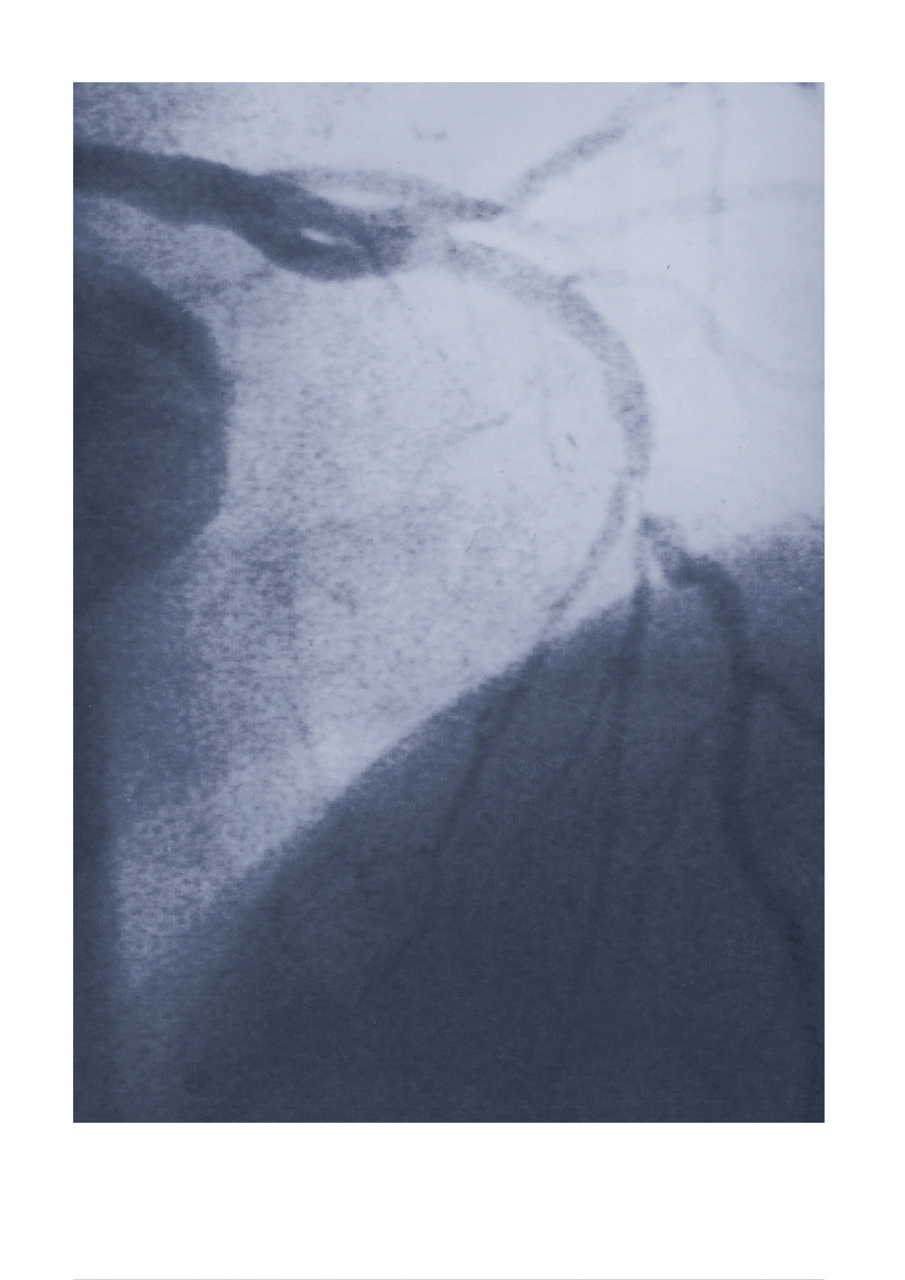 Ce qui reste de la clart� / The remains of clarity #5, 2006